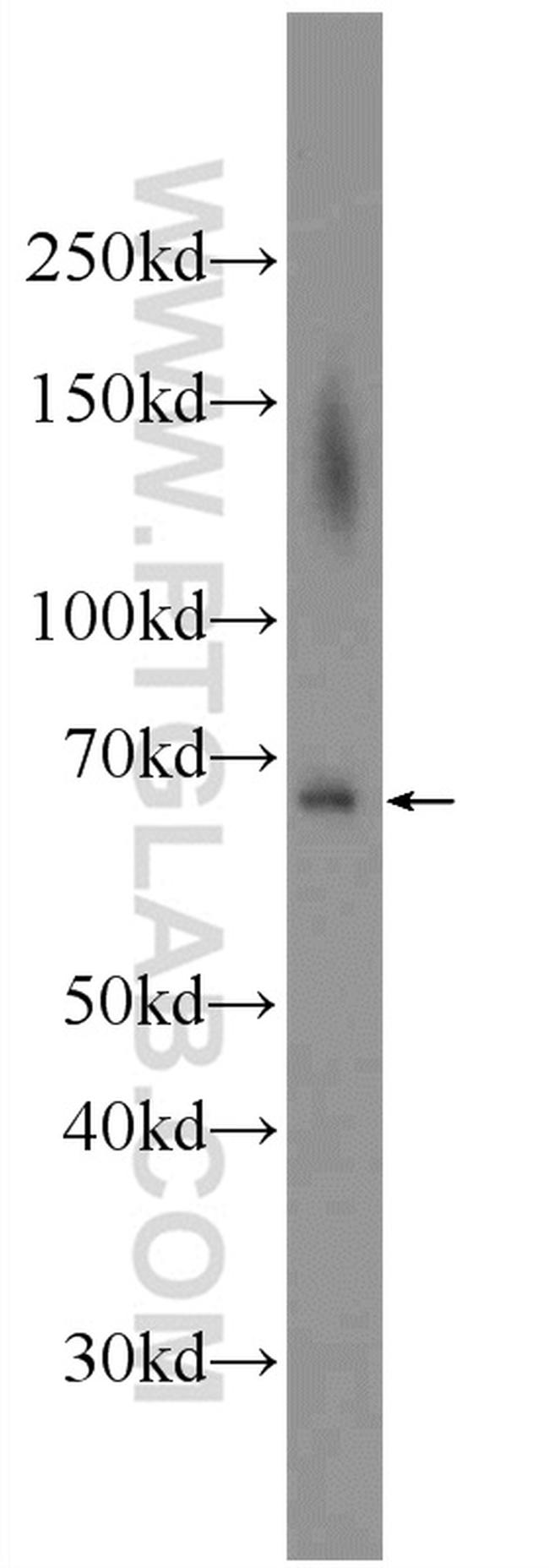 ADAM8 Antibody in Western Blot (WB)