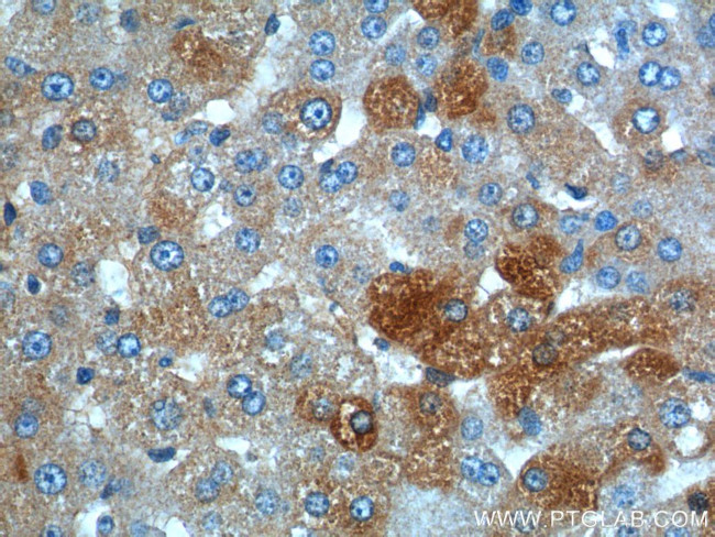 ANGPTL8/Betatrophin Antibody in Immunohistochemistry (Paraffin) (IHC (P))