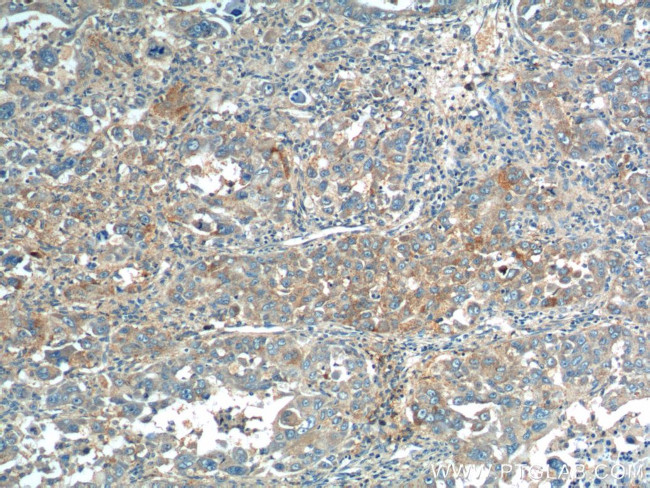 ANGPTL8/Betatrophin Antibody in Immunohistochemistry (Paraffin) (IHC (P))