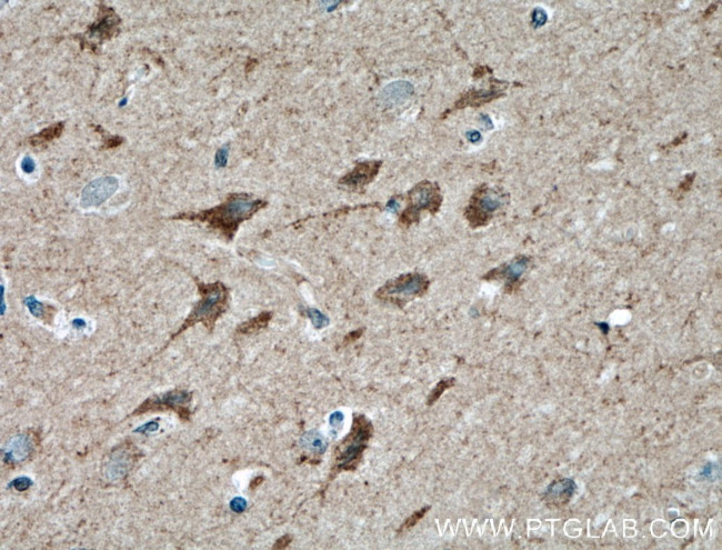 PLXNB1 Antibody in Immunohistochemistry (Paraffin) (IHC (P))