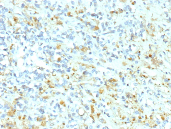 ALK (Anaplastic Lymphoma Kinase)/CD246 Antibody in Immunohistochemistry (Paraffin) (IHC (P))