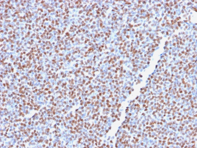 ALK (Anaplastic Lymphoma Kinase)/CD246 Antibody in Immunohistochemistry (Paraffin) (IHC (P))