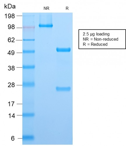 ALK (Anaplastic Lymphoma Kinase)/CD246 Antibody in SDS-PAGE (SDS-PAGE)