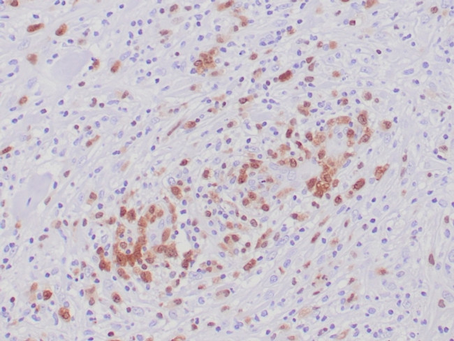 ALK (Anaplastic Lymphoma Kinase)/CD246 Antibody in Immunohistochemistry (Paraffin) (IHC (P))