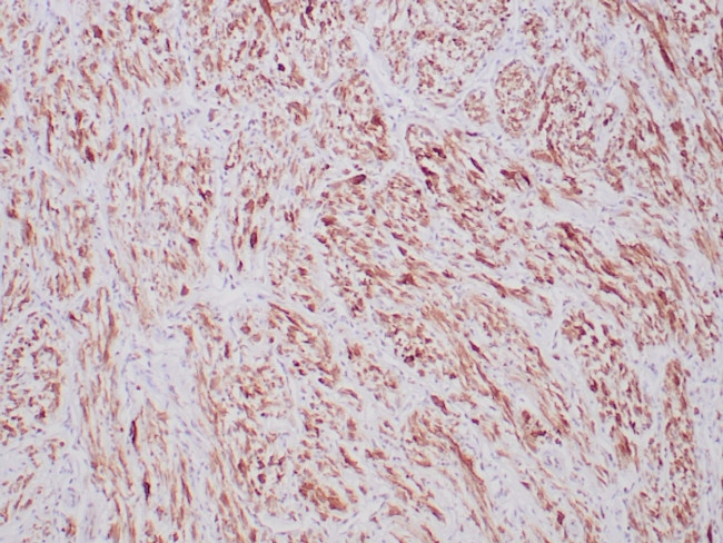 ALK (Anaplastic Lymphoma Kinase)/CD246 Antibody in Immunohistochemistry (Paraffin) (IHC (P))