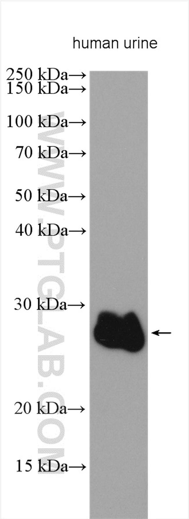 ZG16B Antibody in Western Blot (WB)