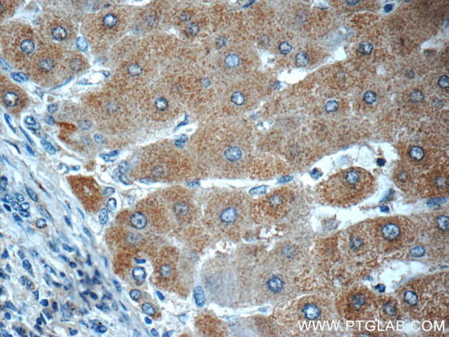 LYRM7 Antibody in Immunohistochemistry (Paraffin) (IHC (P))