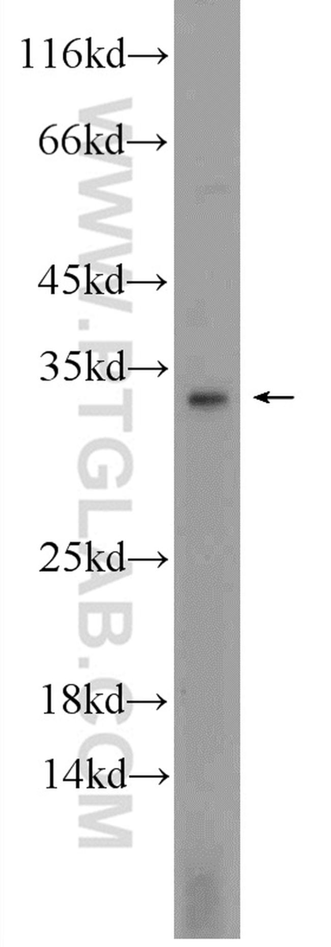 Cathepsin G Antibody in Western Blot (WB)