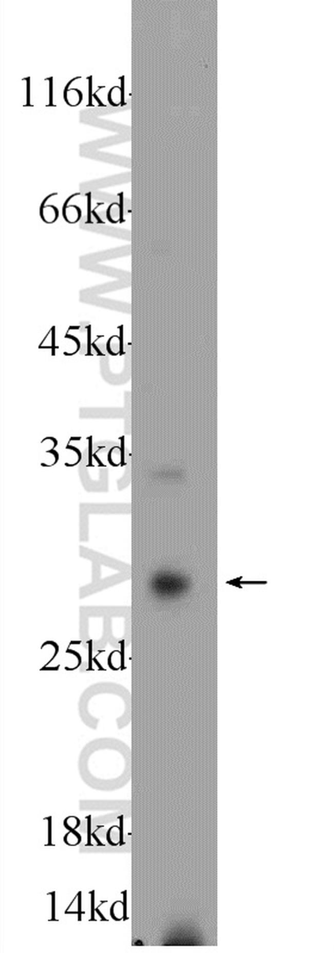 Cathepsin G Antibody in Western Blot (WB)