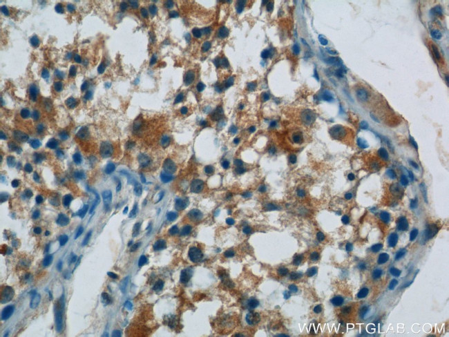 ARCN1 Antibody in Immunohistochemistry (Paraffin) (IHC (P))