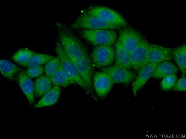 NARG1 Antibody in Immunocytochemistry (ICC/IF)