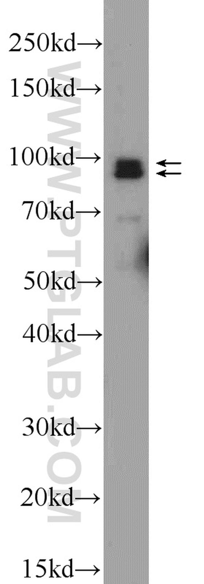 NARG1 Antibody in Western Blot (WB)