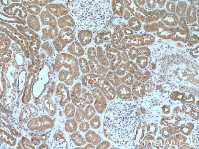 IER2 Antibody in Immunohistochemistry (Paraffin) (IHC (P))