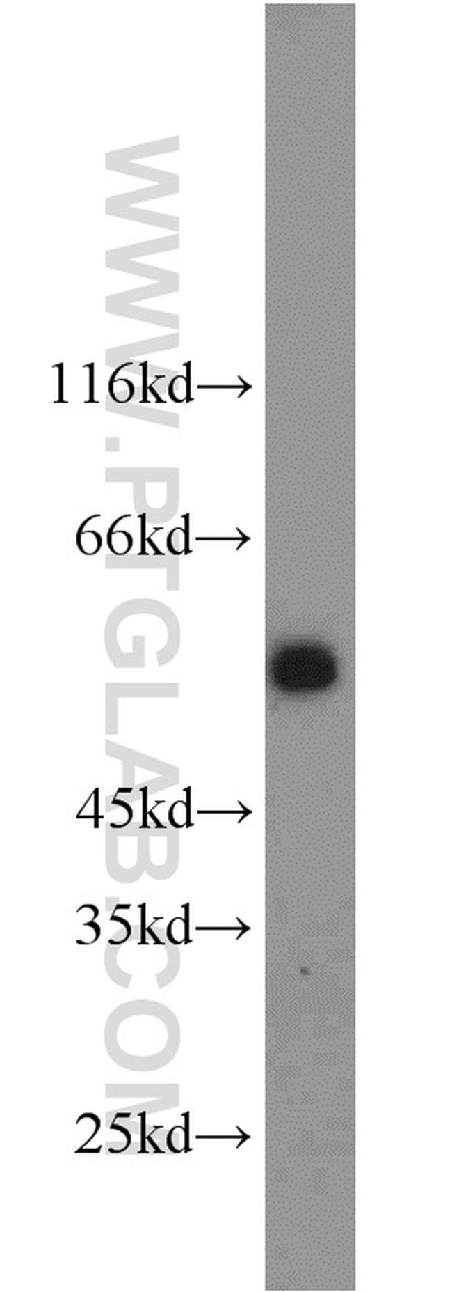 GPR83 Antibody in Western Blot (WB)