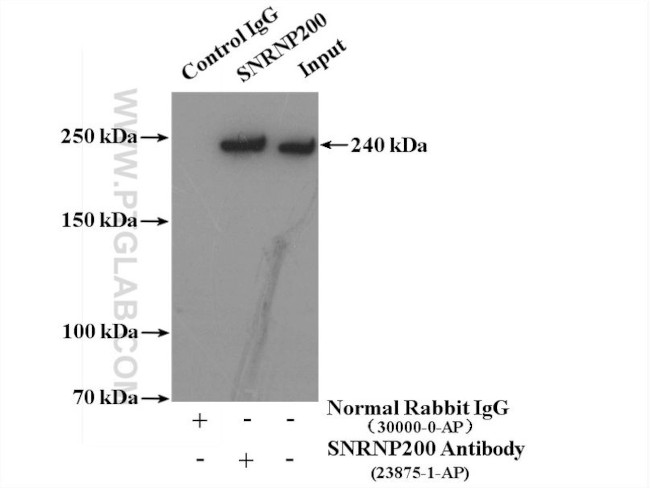 SNRNP200 Antibody in Immunoprecipitation (IP)