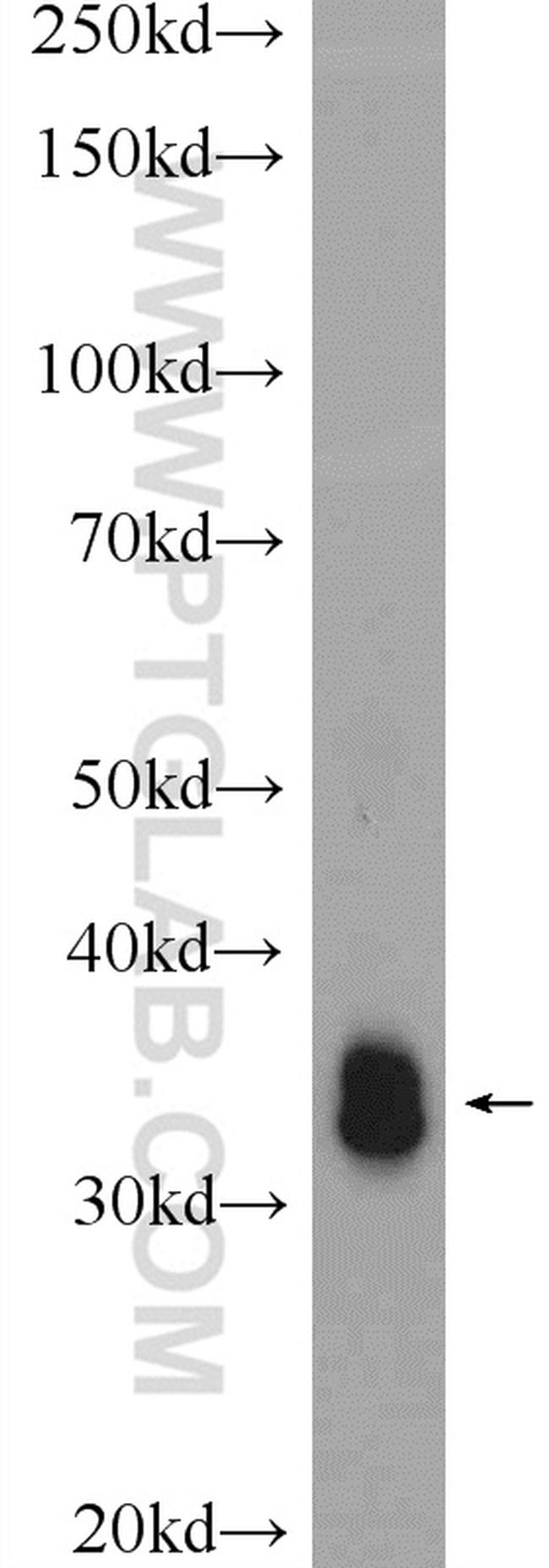 MYOZ3 Antibody in Western Blot (WB)