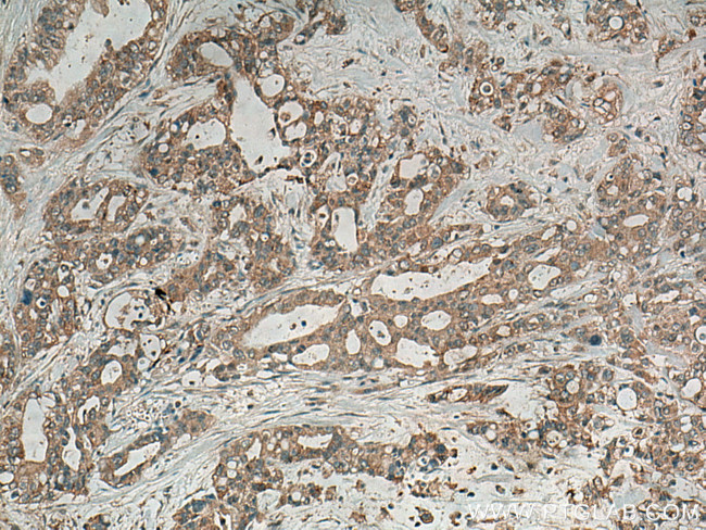 Alpha Internexin Antibody in Immunohistochemistry (Paraffin) (IHC (P))