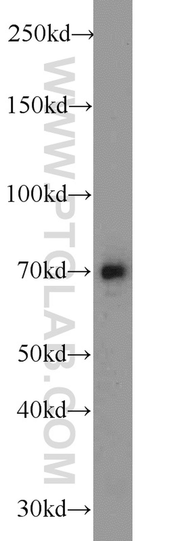 ODF2L Antibody in Western Blot (WB)