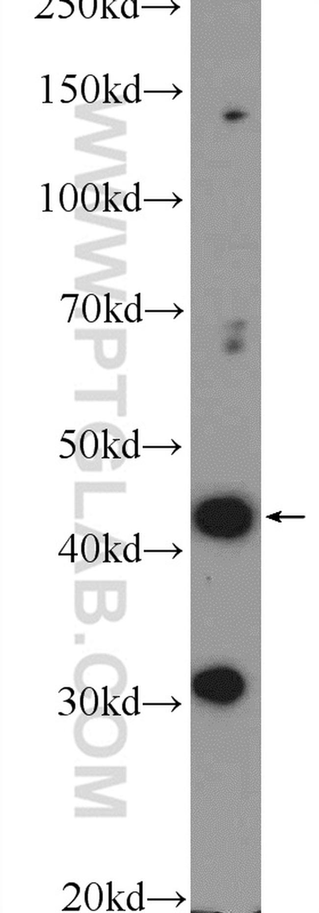 BTBD8 Antibody in Western Blot (WB)