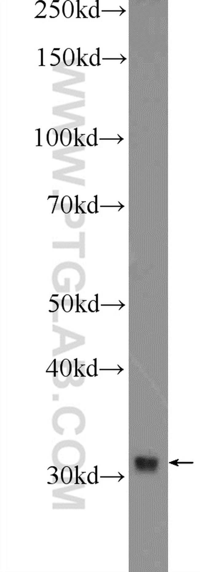 BTBD8 Antibody in Western Blot (WB)