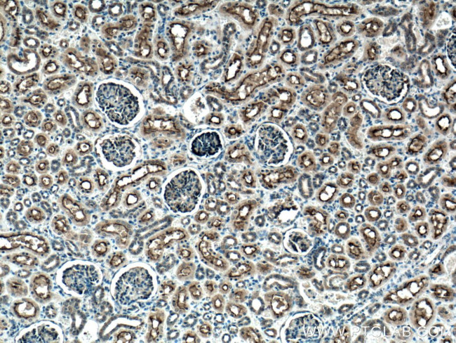 MME/CD10 Antibody in Immunohistochemistry (Paraffin) (IHC (P))