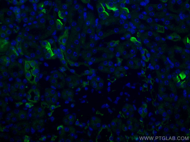 MME/CD10 Antibody in Immunohistochemistry (PFA fixed) (IHC (PFA))