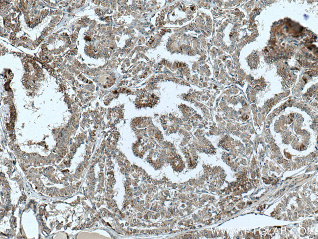 TNFSF18 Antibody in Immunohistochemistry (Paraffin) (IHC (P))