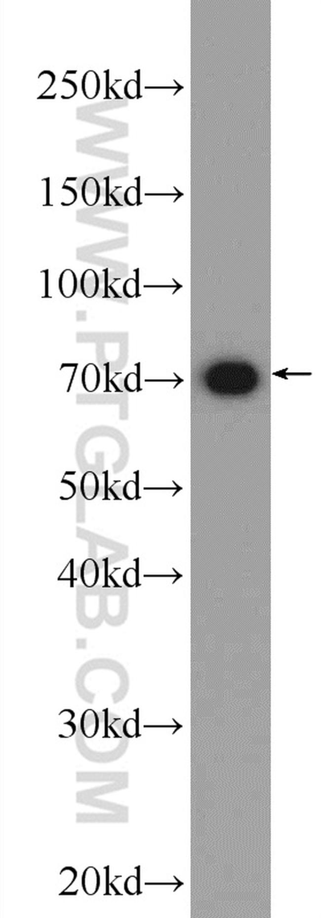 SOLO Antibody in Western Blot (WB)