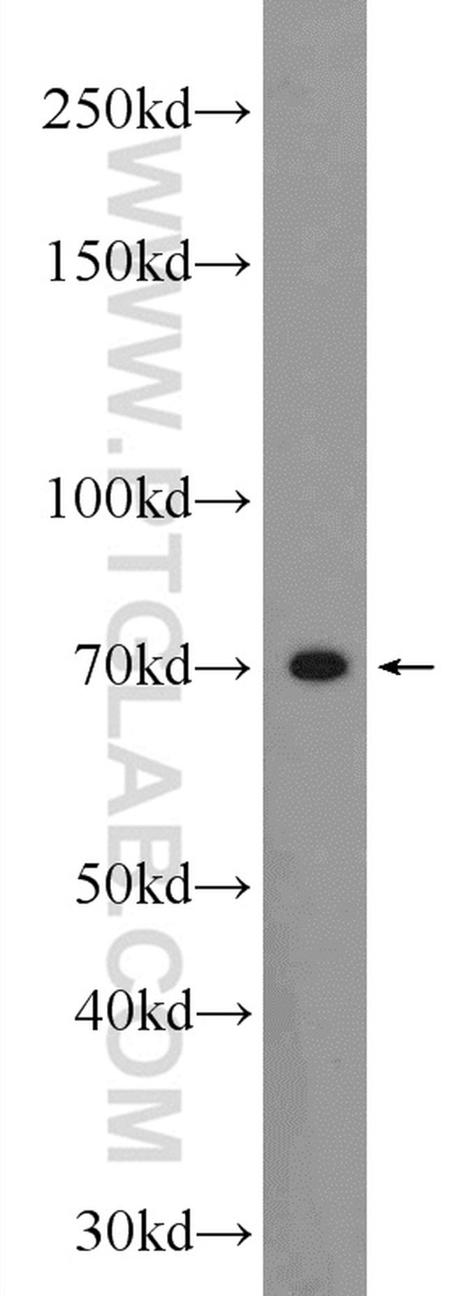 SOLO Antibody in Western Blot (WB)