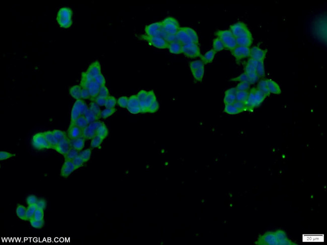 FAM158A Antibody in Immunocytochemistry (ICC/IF)