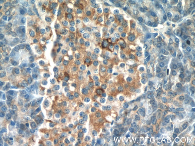 FAM158A Antibody in Immunohistochemistry (Paraffin) (IHC (P))