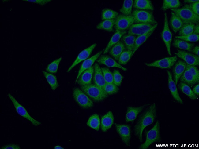 SOX7 Antibody in Immunocytochemistry (ICC/IF)