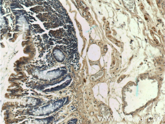 SOX7 Antibody in Immunohistochemistry (Paraffin) (IHC (P))