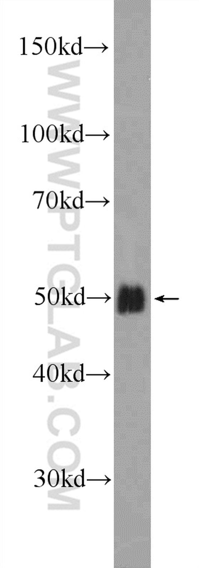 SOX7 Antibody in Western Blot (WB)