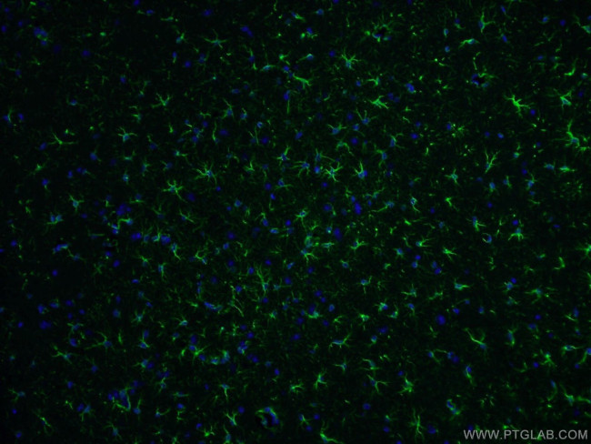 GFAP Antibody in Immunohistochemistry (PFA fixed) (IHC (PFA))