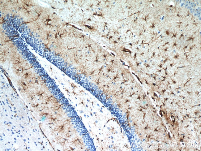 GFAP Antibody in Immunohistochemistry (Paraffin) (IHC (P))