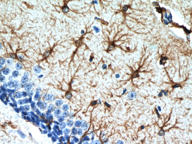 GFAP Antibody in Immunohistochemistry (Paraffin) (IHC (P))