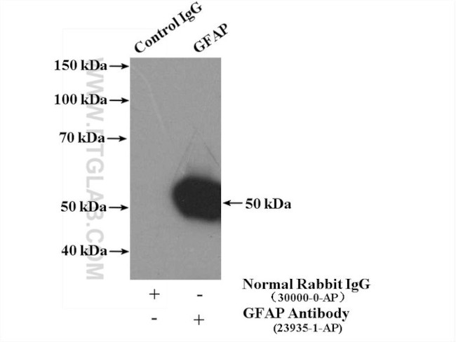 GFAP Antibody in Immunoprecipitation (IP)