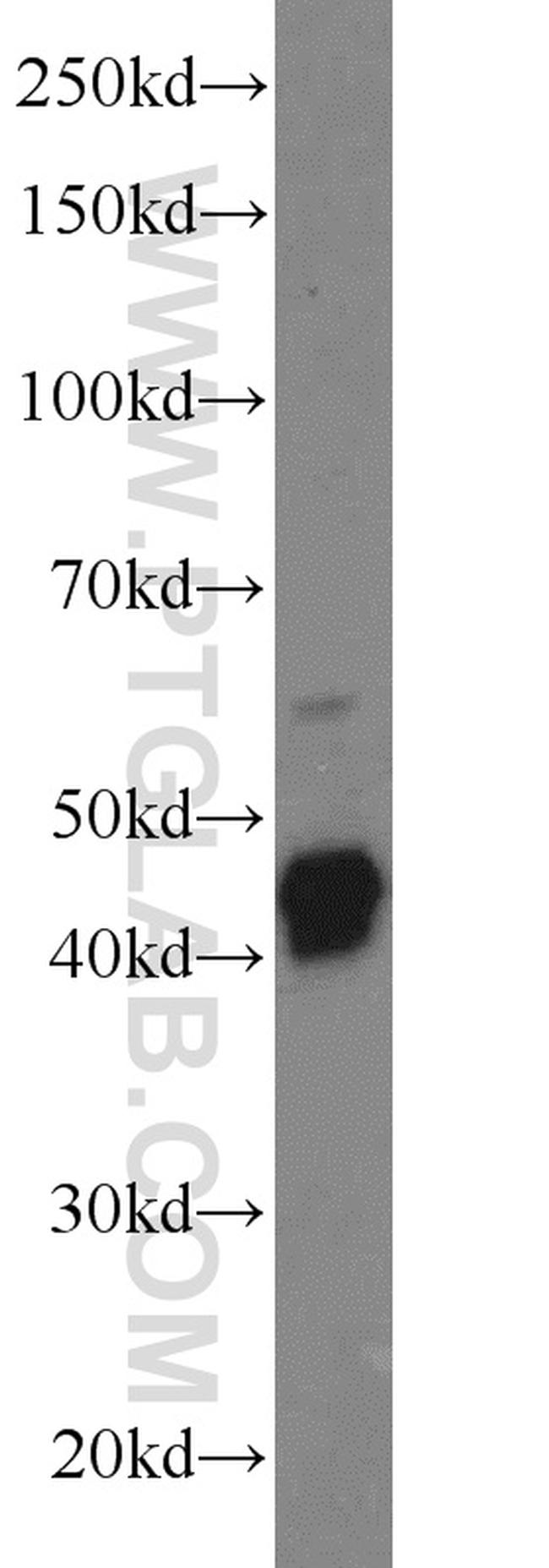 GFAP Antibody in Western Blot (WB)