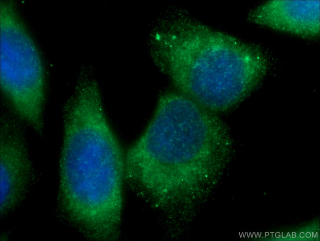 CHPF N-terminal Antibody in Immunocytochemistry (ICC/IF)