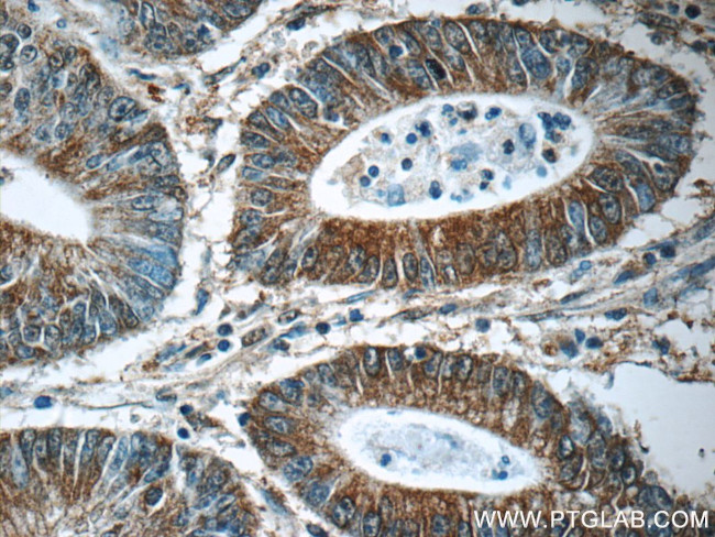 CHPF N-terminal Antibody in Immunohistochemistry (Paraffin) (IHC (P))