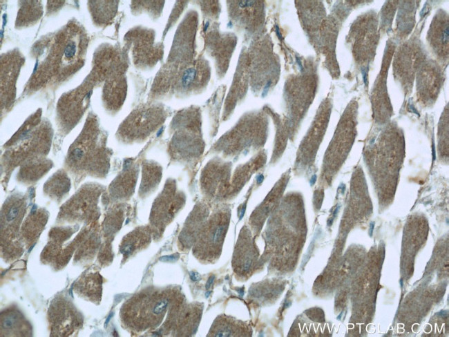 CHPF N-terminal Antibody in Immunohistochemistry (Paraffin) (IHC (P))