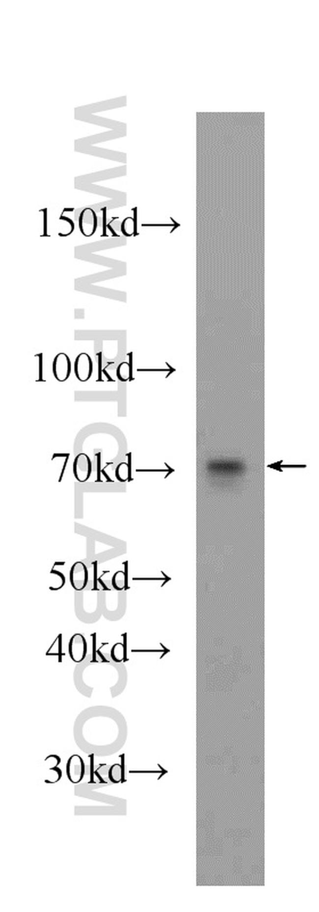 CHPF N-terminal Antibody in Western Blot (WB)