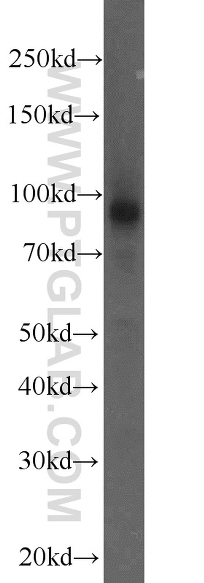 CHPF N-terminal Antibody in Western Blot (WB)