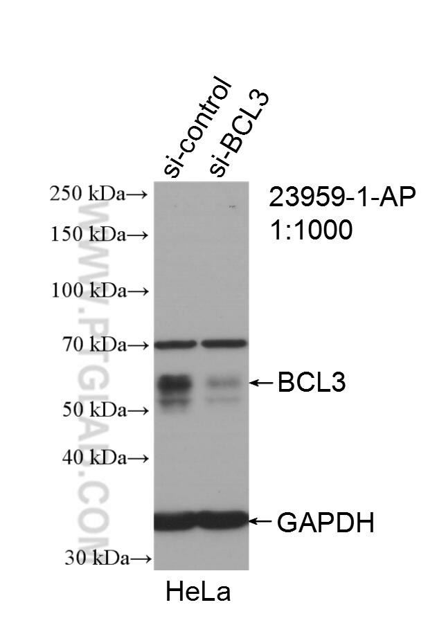 BCL3 Antibody in Western Blot (WB)