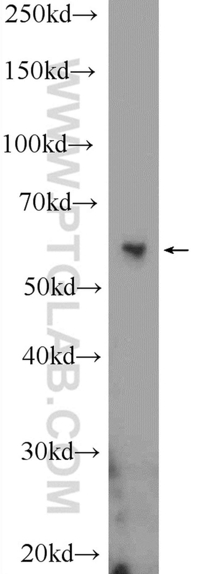 BCL3 Antibody in Western Blot (WB)