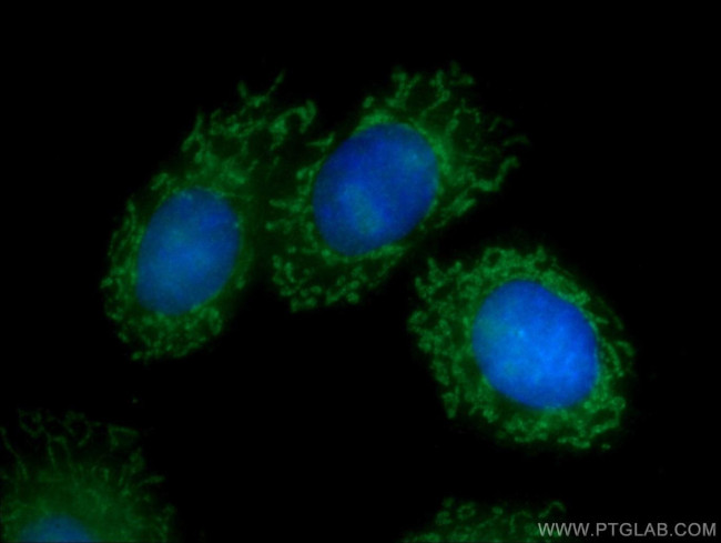 BCL3 Antibody in Immunocytochemistry (ICC/IF)