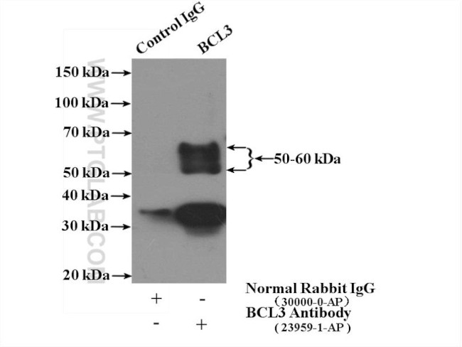 BCL3 Antibody in Immunoprecipitation (IP)