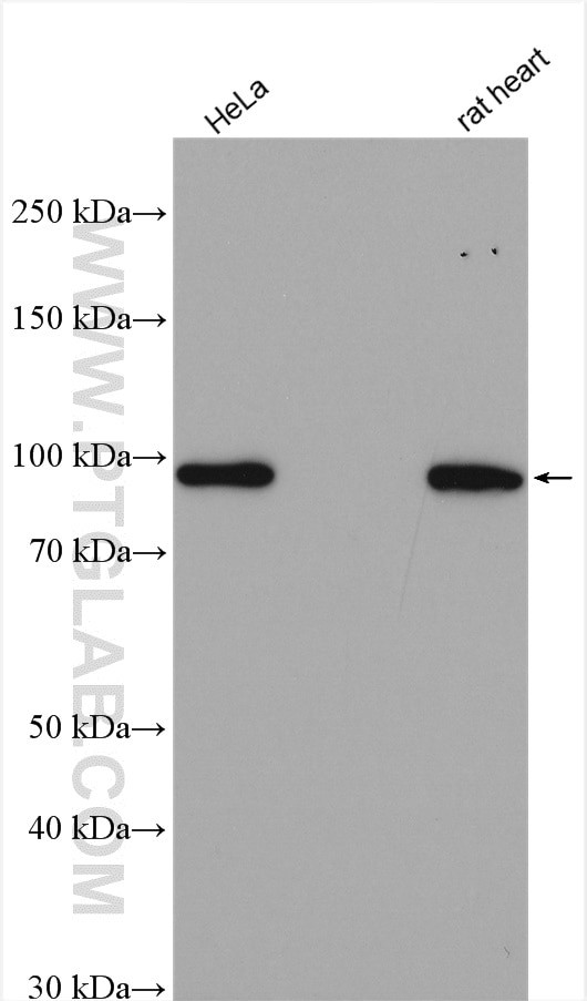 STRN3 Antibody in Western Blot (WB)