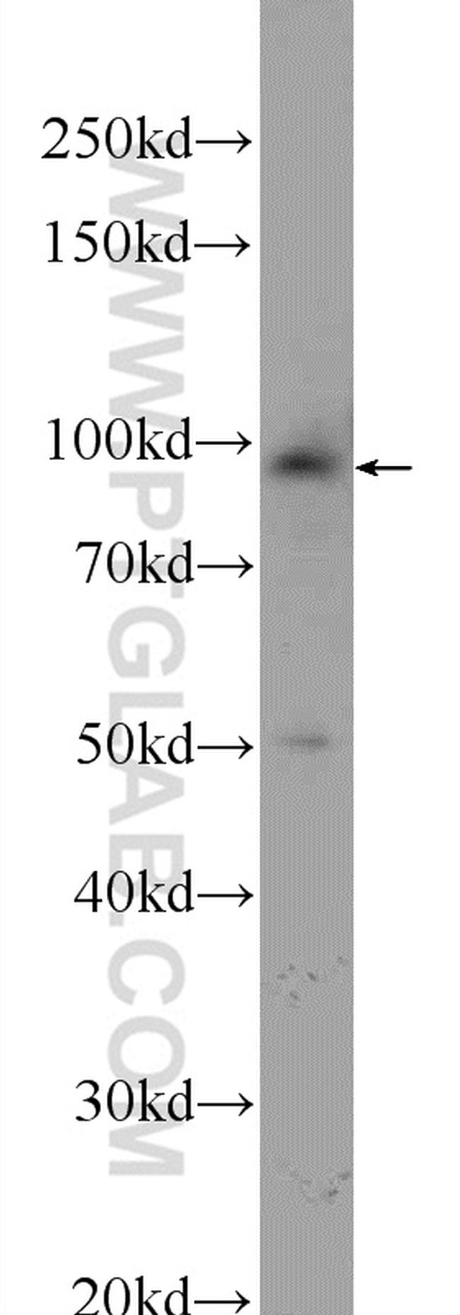 STRN3 Antibody in Western Blot (WB)